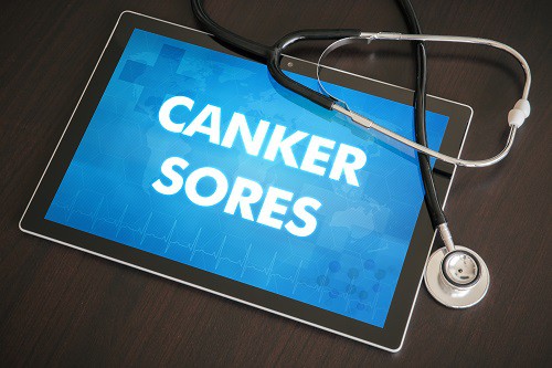 canker sore - Avery & Meadows Dental Partnership
