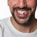 man with missing tooth - Avery & Meadows Dental Partnership